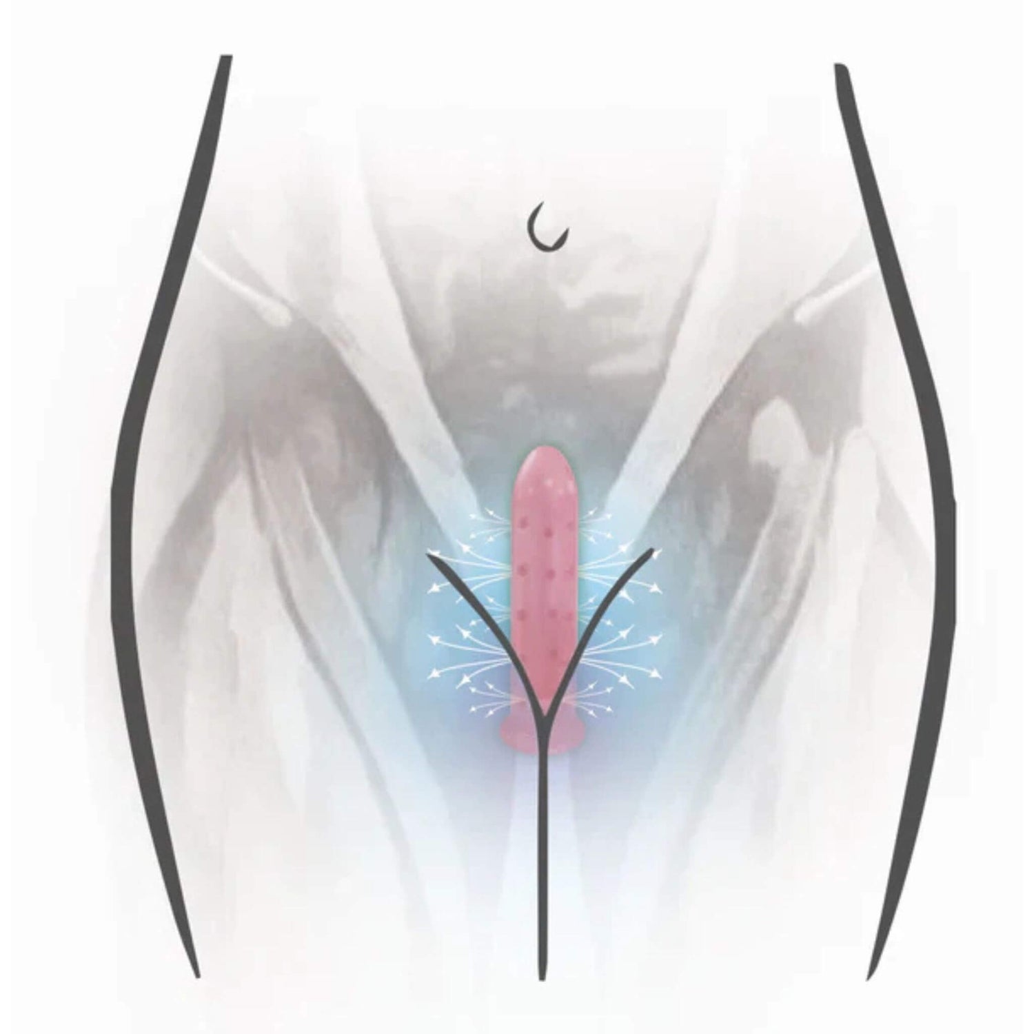 Vuvatech Dilatador Magnetico Vaginismo Uso